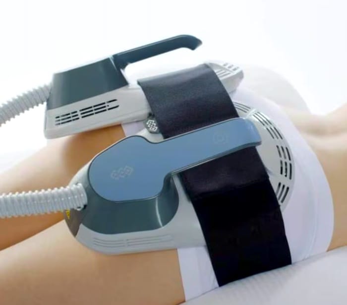 tratamiento de radiofrecuencia en clinica estetica en alcorcon