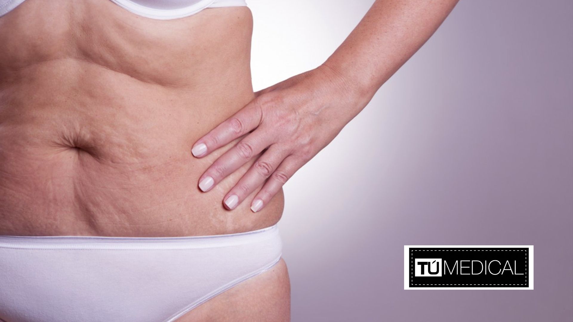 Cómo eliminar la flacidez abdominal