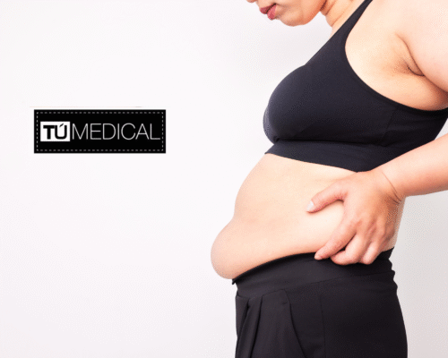 Eliminar flacidez abdominal