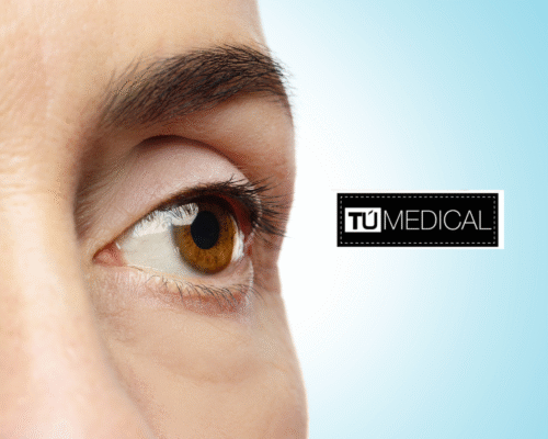 tratamientos para ojeras