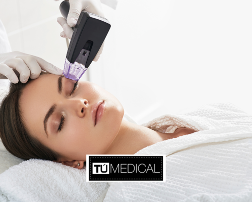 radiofrecuencia facila en alcorcón