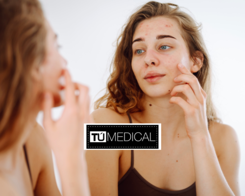 Revitalización cutánea sin cirugía