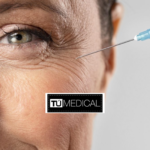 Tratamientos con bótox en Alcorcón