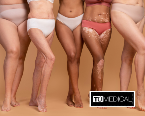 Eliminar la celulitis