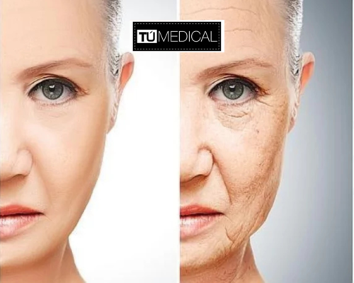 prevenir el envejecimiento facial