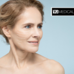 Sculptra en Madrid sur