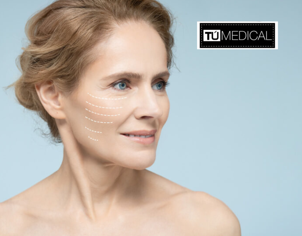 Sculptra en Madrid sur