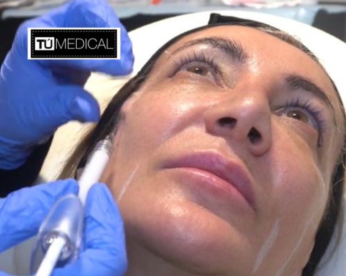 Sculptra en Madrid sur