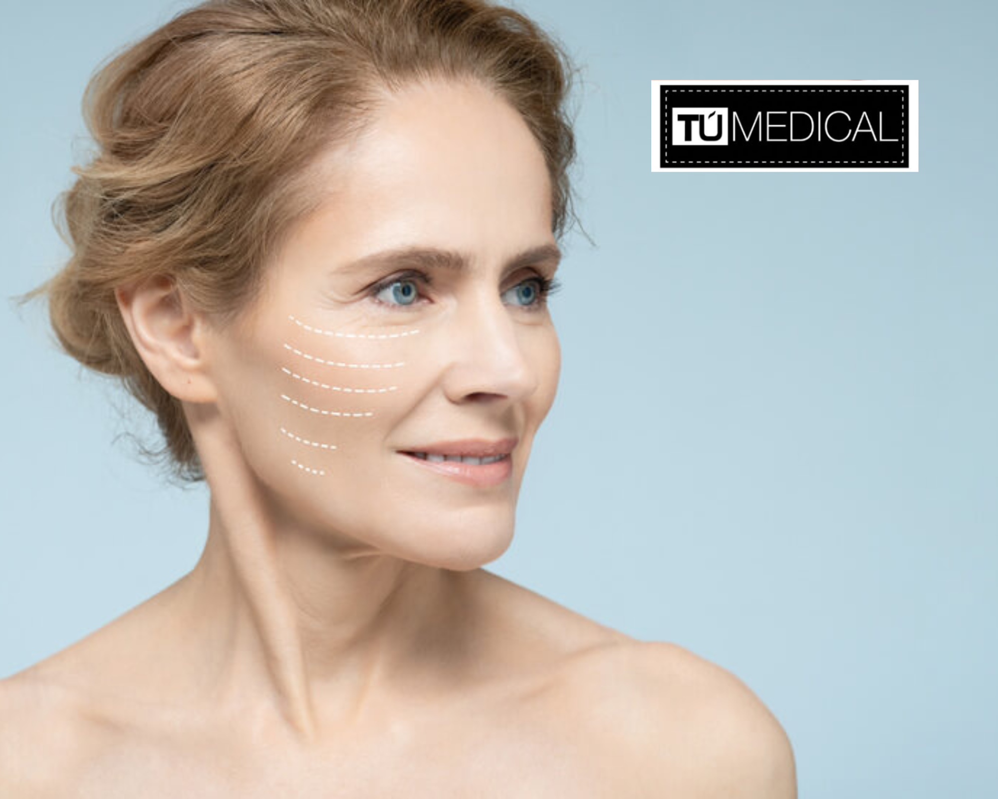 Sculptra en Madrid sur