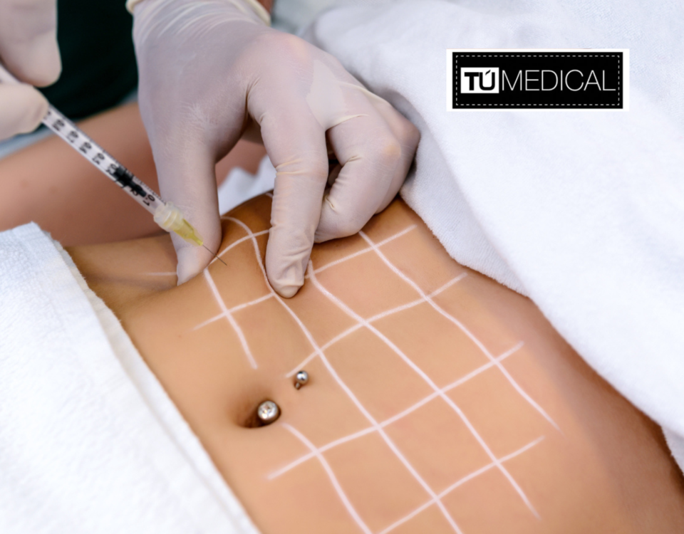 Mesoterapia en Alcorcón