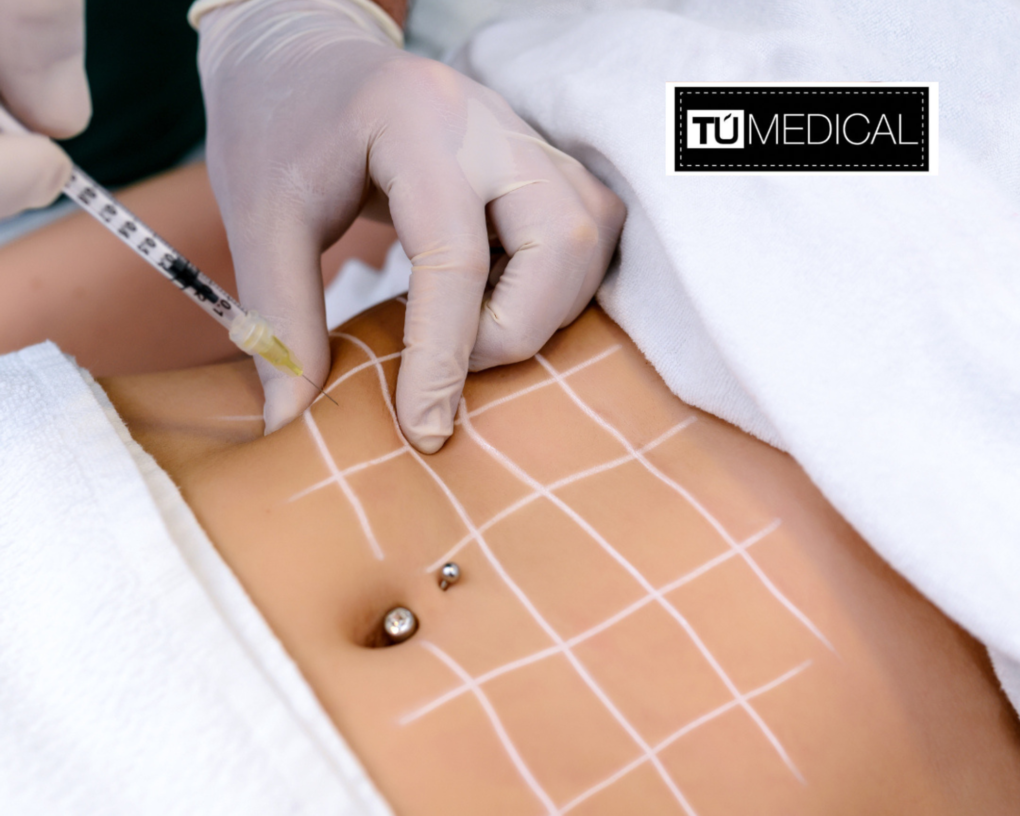 Mesoterapia en Alcorcón